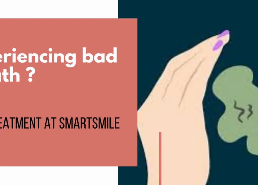 Bad smell Breath (Halitosis) bySmartsmile Dental Clinic