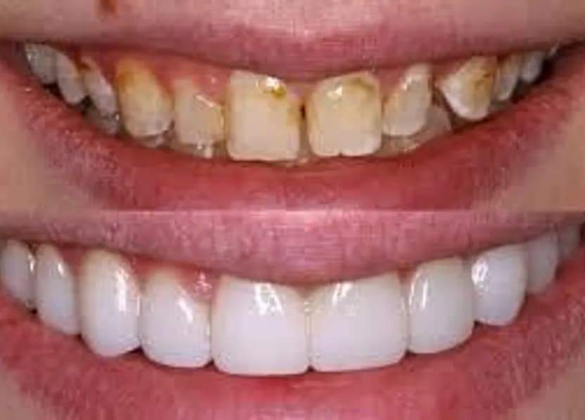 Aesthetic dentistry (Cosmetic Dentalcare) image Smartsmile Dental Clinic